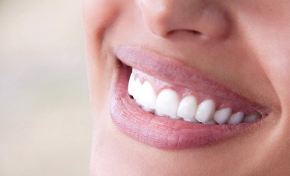 Woman receiving in office teeth whitening