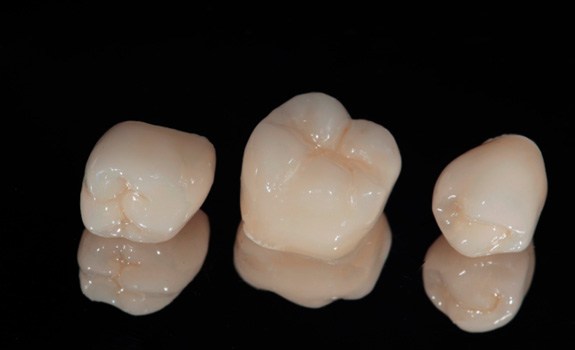 Row of three porcelain crowns on dark reflective surface 