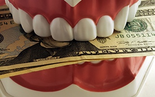 Model of teeth holding money