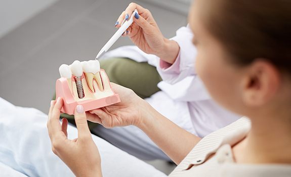 Dentist showing patient a dental implant model