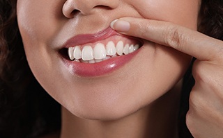 A woman with healthy gums