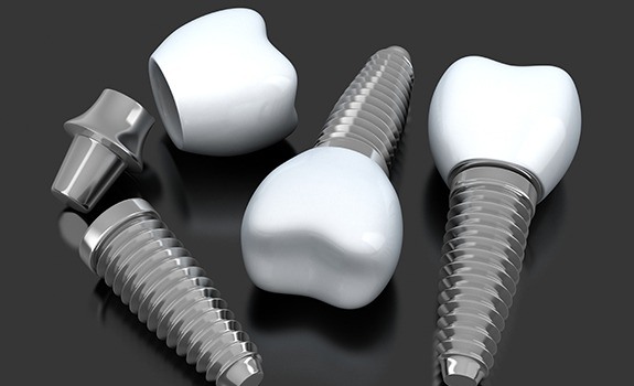 Three animated dental implant supported replacement teeth