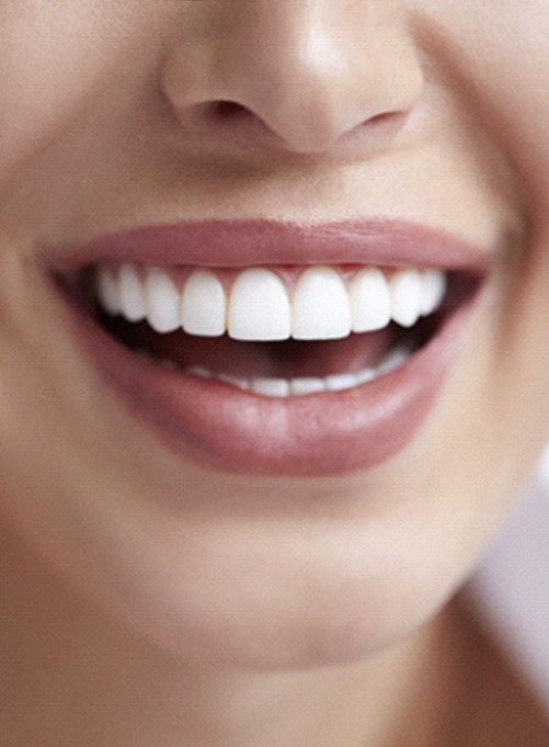 Happy, healthy smile after smile makeover in Lakewood