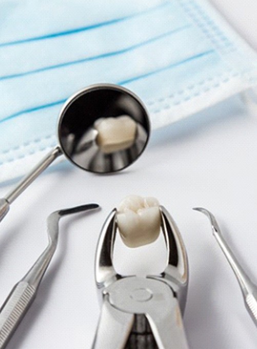 Dental tools holding tooth after tooth extraction in Lakewood