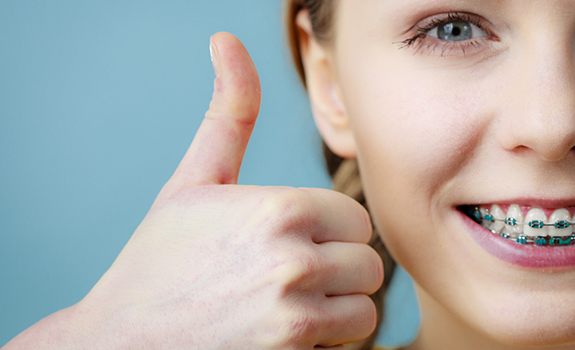 Woman with braces giving a thumbs up