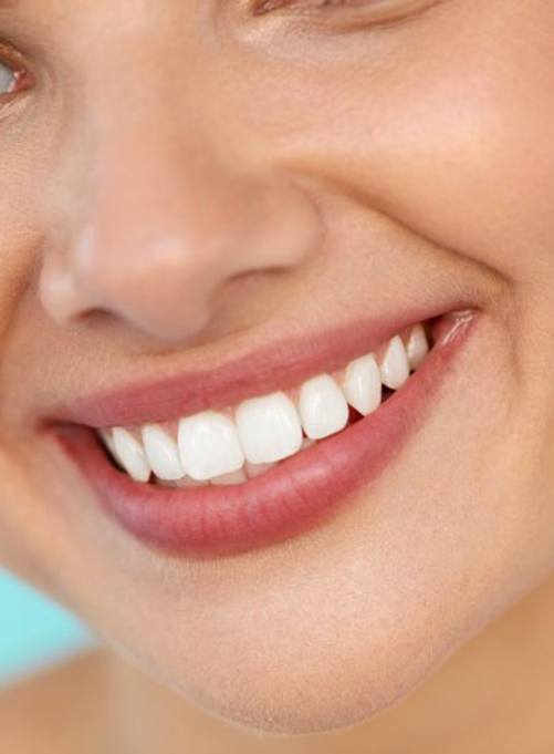 Woman with veneers smiles at Lakewood cosmetic dentist