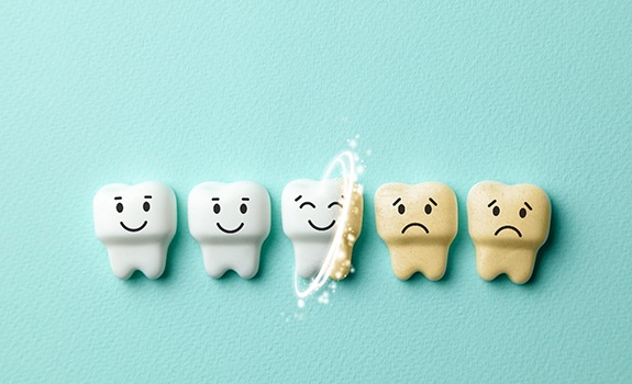 Illustration of teeth whitening