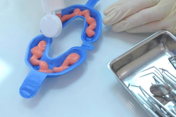 A fluoride tray from a dentist